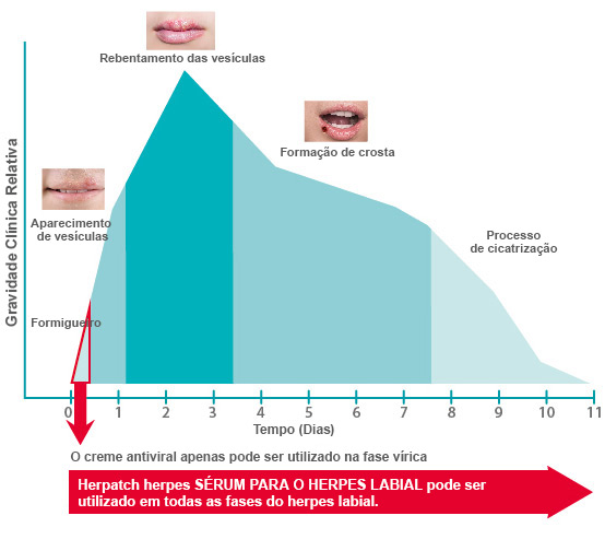 stages-of-a-blister-outbreak_pt