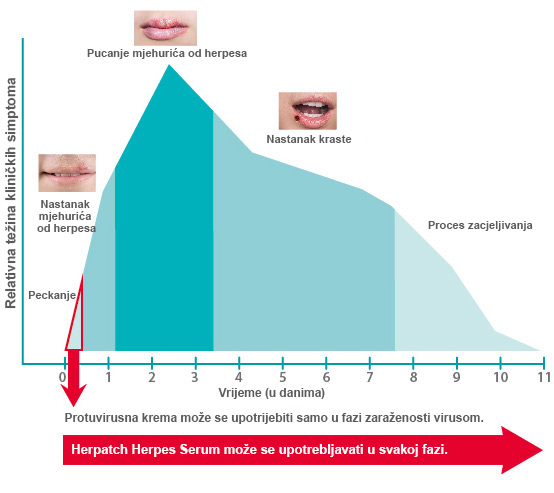 stages-of-a-blister-outbreak_hr